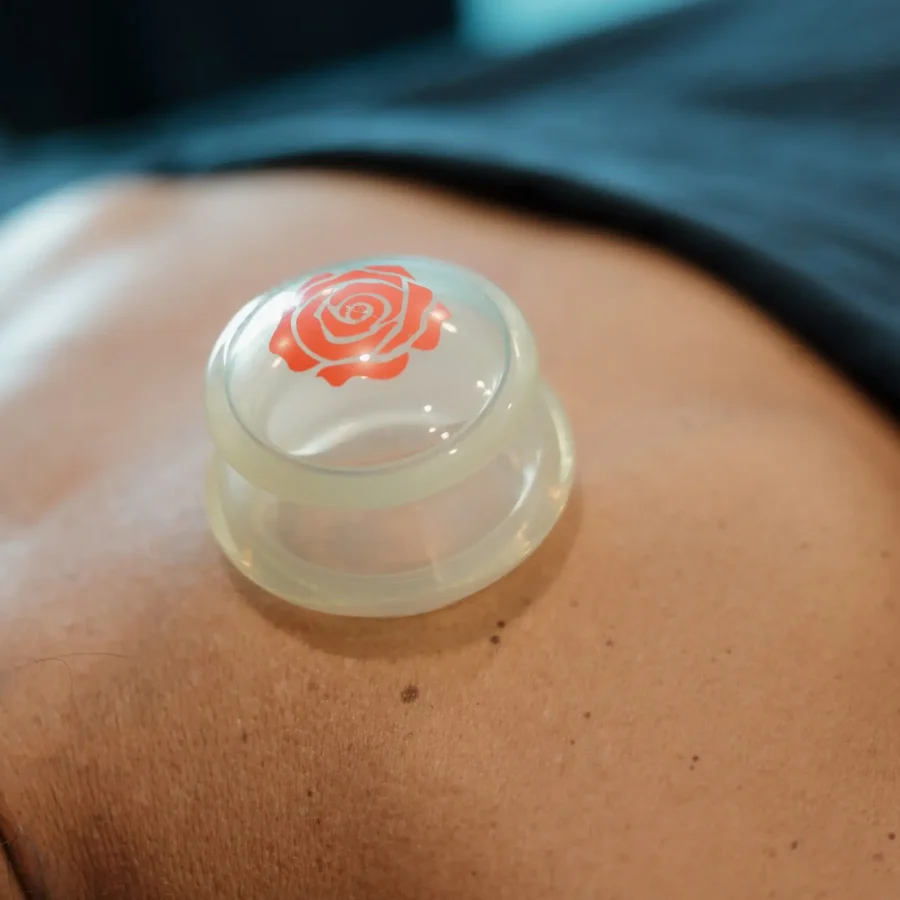Cupping Massage